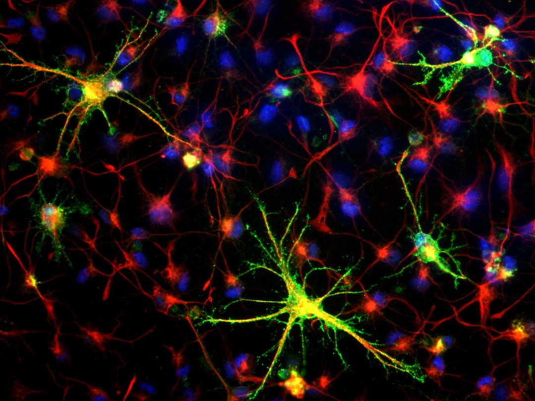 Neuron connections