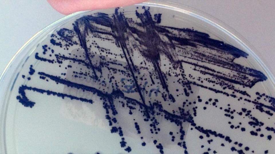 C. difficile in petri dish External link: (https://healthcare.utah.edu/newsroom/news/2025/04/research-uncovers-hidden-spread-of-one-of-most-common-hospital-associated)